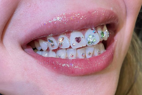 Tooth Gems